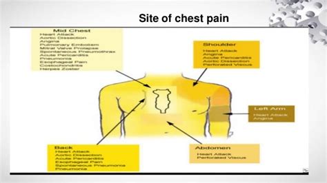 Chest Pain Ppt By Dr Bidya Sms Jaipur