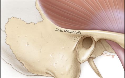 Overview Of Temporal Bone Oto Surgery Atlas