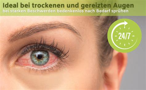 TEARS AGAIN Fresh 10ml Augenspray gegen trockene Augen auch für