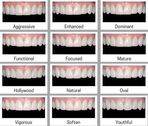 Pin by Bob on Veneers | Dentist, Dental, Health