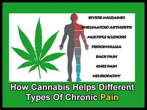 First Comprehensive Guide To Using Cannabis For Treating Chronic Pain