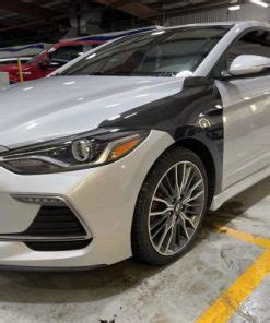 Elantra Sport Non Sport Carbon Fiber Fenders Socal Garage