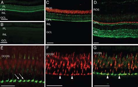 Pitpnb Immunolocalization In The Adult Zebrafish Retina A