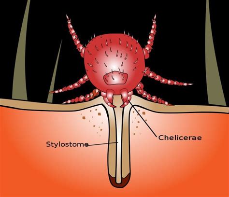 It's chigger season again! What are chiggers, anyway? | STLPR