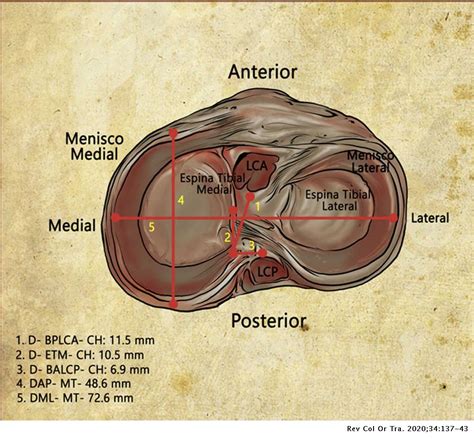 Descripción Anatómica De La Inserción De La Raíz Del Cuerno Posterior