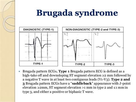 Ecg in athletes and young age