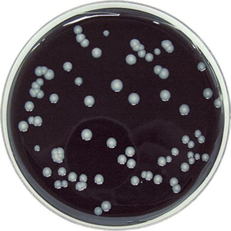 Legionellosi Infezione Polmonare Causata Dalla Legionella Pneumophila