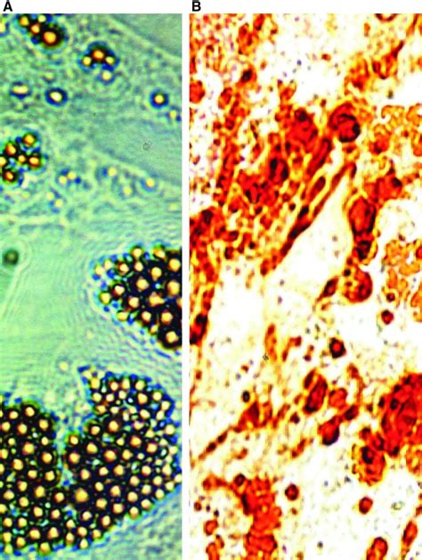 Adipogenesis Differentiation A And Osteogenesis Differentiation B