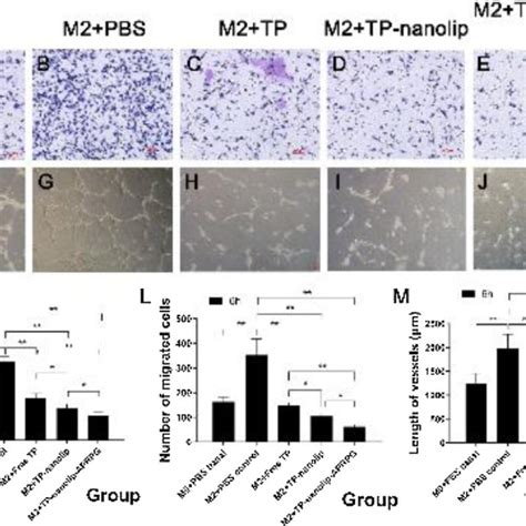 Triptolide Inhibited M Macrophage Induced Cell Proliferation