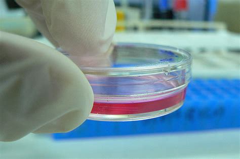 Difference Between In Vitro and In Vivo | Compare the Difference Between Similar Terms