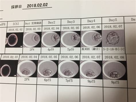 採卵周期のまとめ みきでつさんのブログ 【子宝ねっと】不妊治療の交流サイト