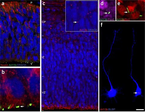 Primary Cilia In Neuroepithelial Cells And Cortical Progenitors A Download Scientific Diagram