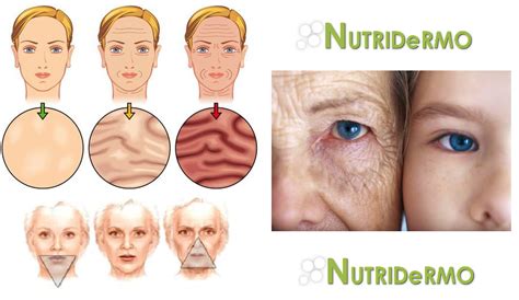 Las Arrugas Clasificaci N De Los Distintos Tipos De Arrugas En Funci N