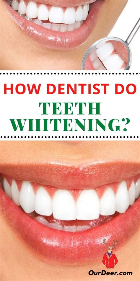 Just How To Whiten Your Teeth Naturally 6 Home Remedies