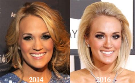 Carrie Underwood Plastic Surgery Before and After Photos - Latest ...