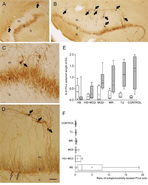 Photomicrograph Showing Ectopic Pv Immunoreactive Neurons In The