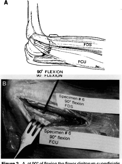 Figure 2 From Functional Anatomy Of The Flexor Pronator Muscle Group In