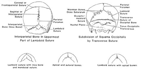 Sutural Bones.