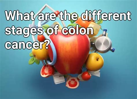 What Are The Different Stages Of Colon Cancer Health Gov Capital