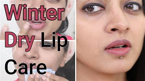 Winter Lip Care Tips How To Prevent And Treat Dry Lips Youtube