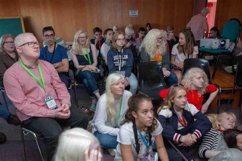 Encuentro De J Venes Con Albinismo Alba Asociaci N De Ayuda A