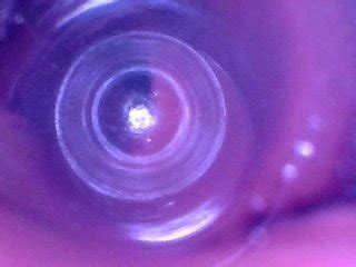 内窥镜之旅进入我最深的肠道 预览 Pornhub Gay