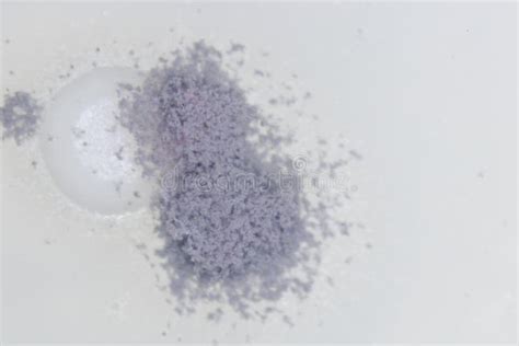 aspergillus mold  microbiology stock photo image  medicine