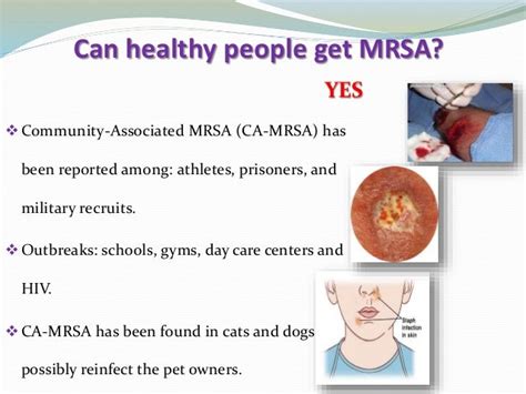 Understanding Mrsa