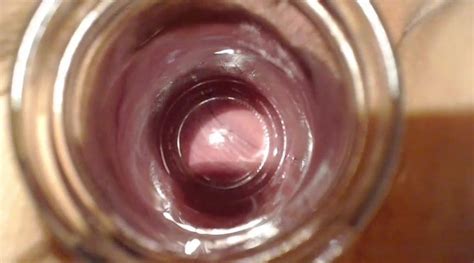 Jar And Funel In Pussy Strech And Show Cervix In English Porn XHamster