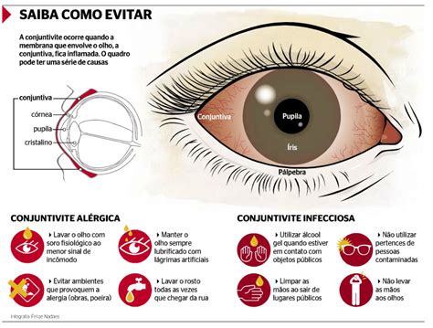 Conjuntivite Febre Bebe - sexo, amor, família, gravidez e paternidade: causa conjuntivite
