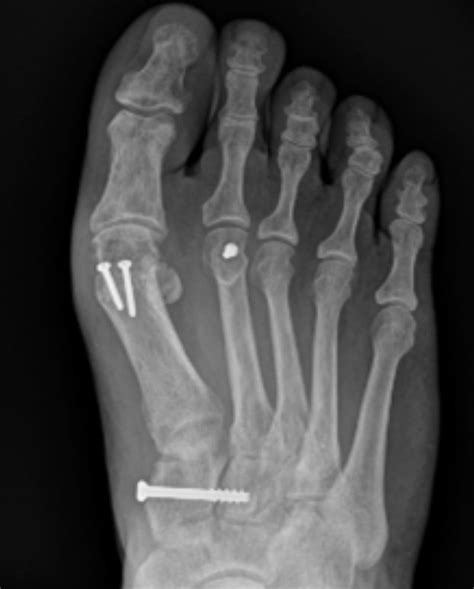 Dr. Jason Bruse | West Layton UT