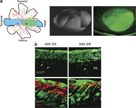 Tropism Of Aav25 And Aav28 Vectors Subretinally Injected In The