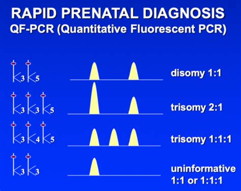 Prenatal genetic testing and screening Flashcards | Quizlet