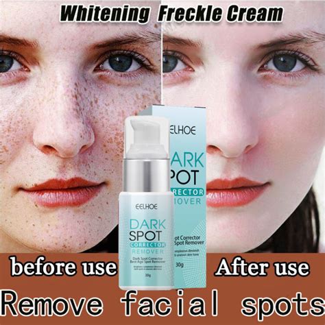 SUPER TRENDING Eelhoe Dark Spot Corrector Remover This Dark Spot