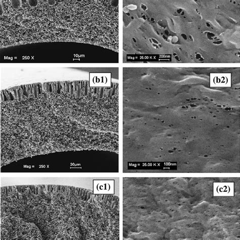 Fesem Micrographs Of Cross Section And Outer Surface Of Pvdf