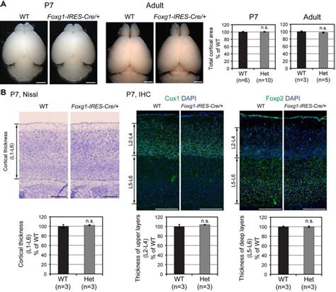 cortical size cortical thickness  layer pattern formation