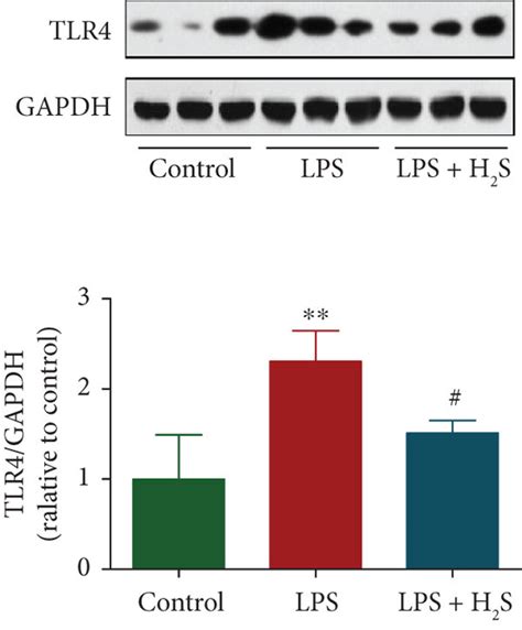 Effects Of H2s On The Cytokine Levels And The Tlr4nf κb Signaling