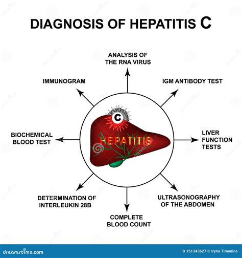 Diagnosis Of Hepatitis C World Hepatitis Day Infographics Vector