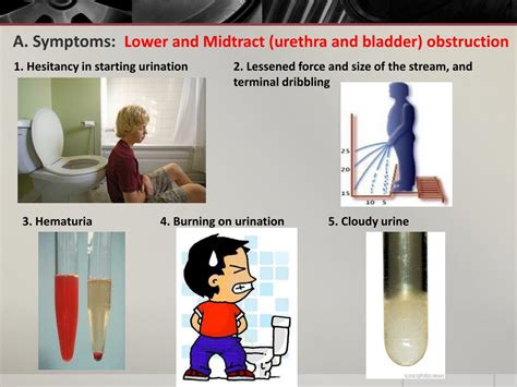 Ppt Urinary Obstruction And Stasis Powerpoint Presentation Free Download Id 5872127