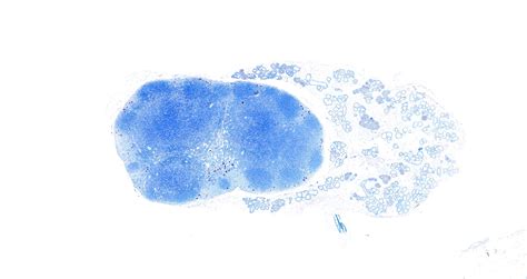 Ihisto Toluidine Blue Stain