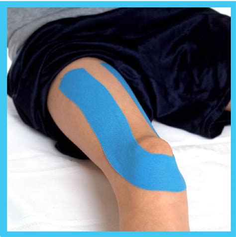 Patellar Tendonitis – Pediatrics – Kinesio
