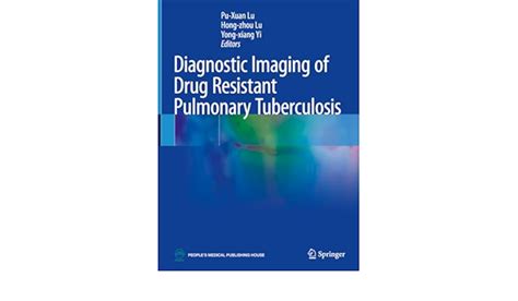 Diagnostic Imaging Of Drug Resistant Pulmonary Tuberculosis Libreria