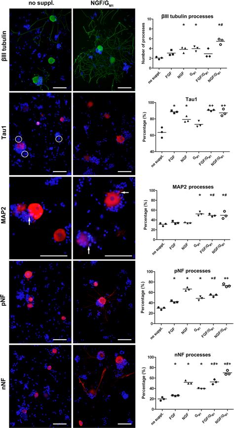 Neuronal class III β tubulin Tau1 MAP2 phosphorylated neurofilament