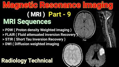 MRI Part 9 MRI Sequences PDW FLAIR STIR DWI Sequences