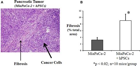 Frontiers Stars And Stripes In Pancreatic Cancer Role Of Stellate