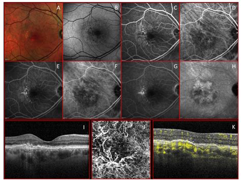 Applied Sciences Free Full Text Optical Coherence Tomography