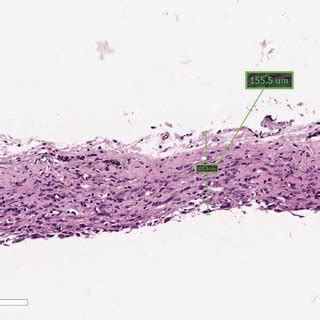 Histological View Of Capsular Thickness A Representative Histological