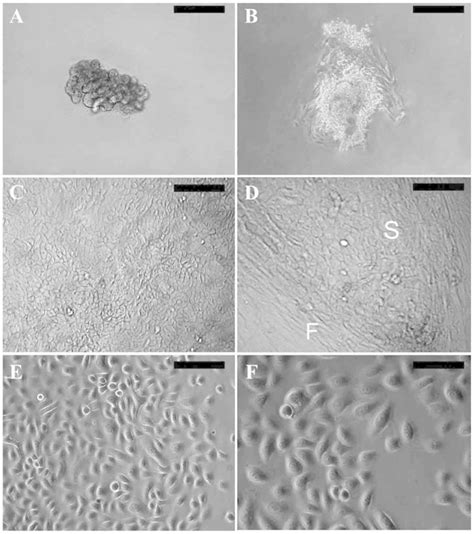 Isolation And Cultivation Of Human Sweat Gland Epithelial Cells