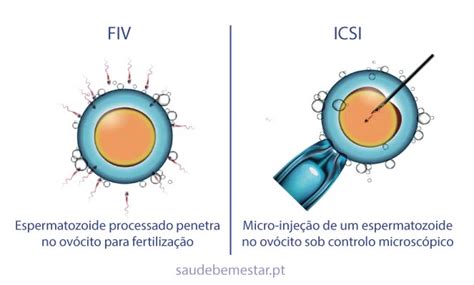 Insemina O Artificial Vs Fertiliza O In Vitro Qual A Diferen A