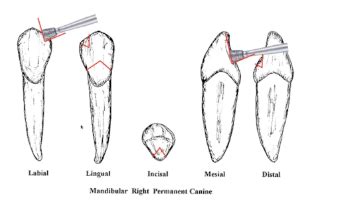 Abutment Tooth Modification Flashcards Quizlet